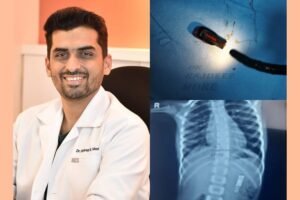 A Pen Drive Accidentally Swallowed By A 5-Year-Old Boy Removed Endoscopically, there by avoiding major surgery