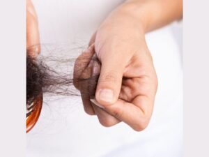 Causes of Hair Loss, Homeopathic Remedies for Hair fall