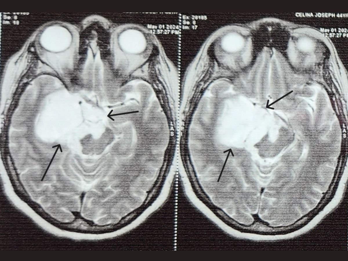 027601-Image-July-15